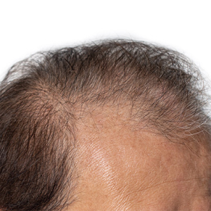 Лечебная косметика от выпадения волос